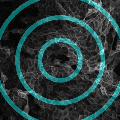 Radial Wave